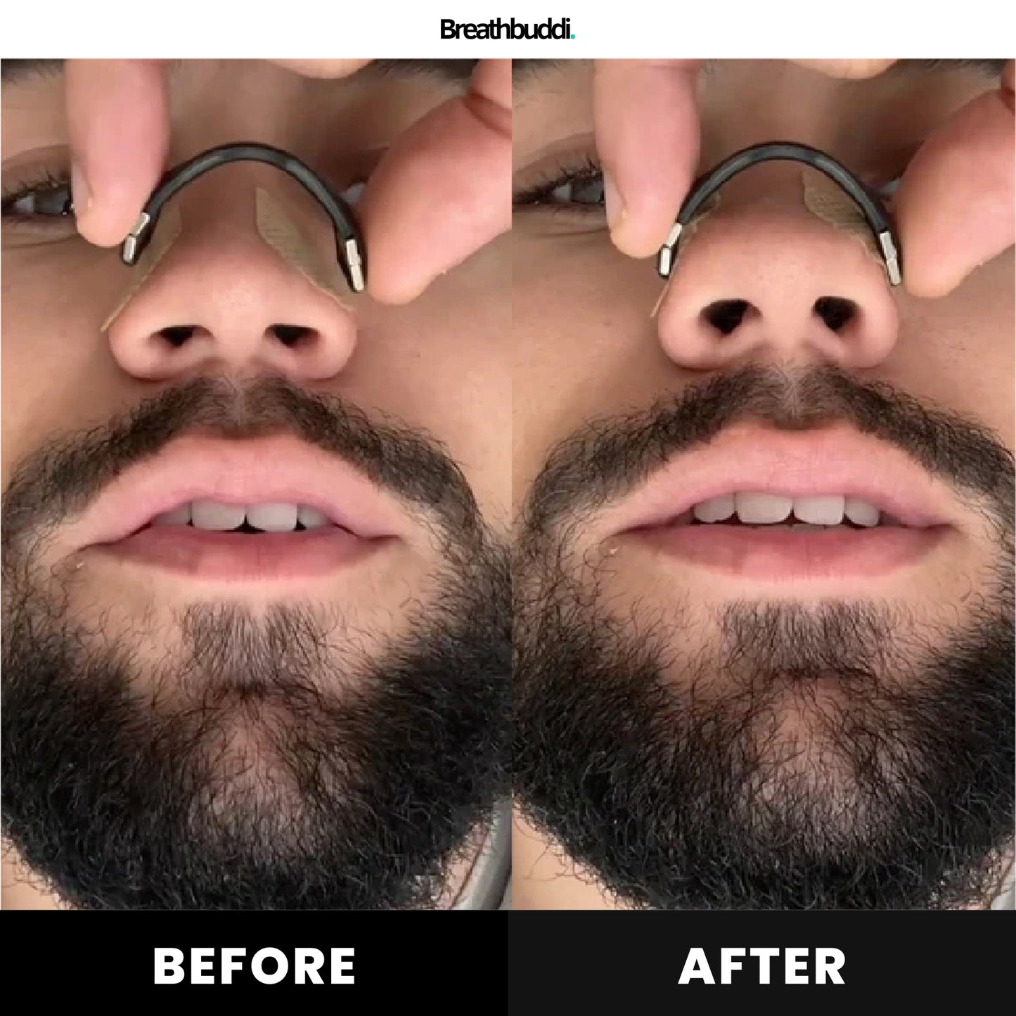 The ULTIMATE snoring Solution